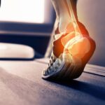 How to Relieve Heel Pain After Running